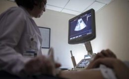 Endometriozis: Çikolata Kisti ve Kadın Yaşam Kalitesi Üzerindeki Etkileri