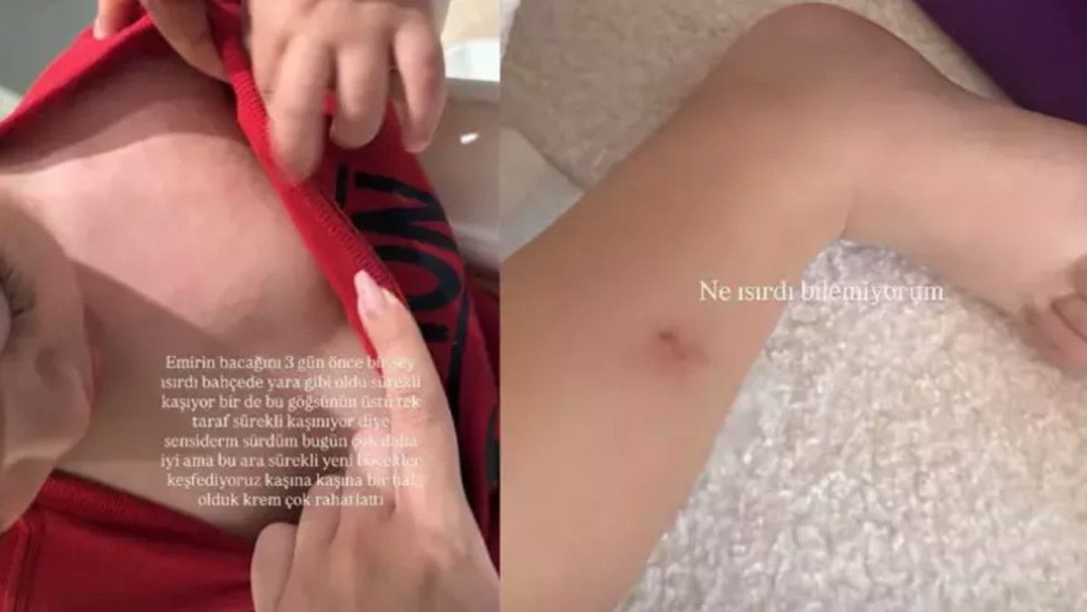 İdo Tatlıses ve Yasemin Şefkatli'nin İkiz Oğullarıyla Gelen Mutluluk ve Sağlık Hikayesi