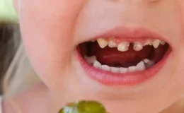 Okul Çağı Çocuklarda Diş Sağlığı ve Beslenme: Çürüğe Karşı Akıllı Seçimler