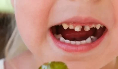 Okul Çağı Çocuklarda Diş Sağlığı ve Beslenme: Çürüğe Karşı Akıllı Seçimler